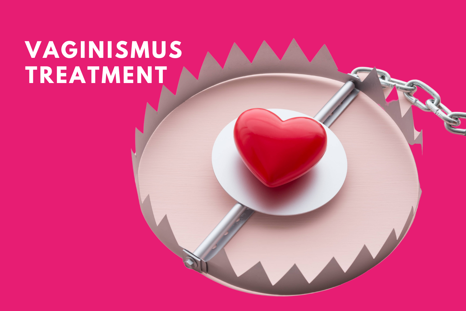 Vaginismus Treatment